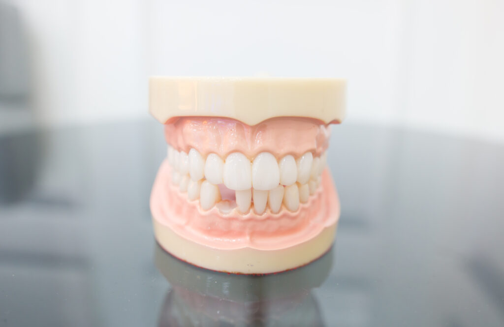 A 3D model of a mouth with a missing tooth
